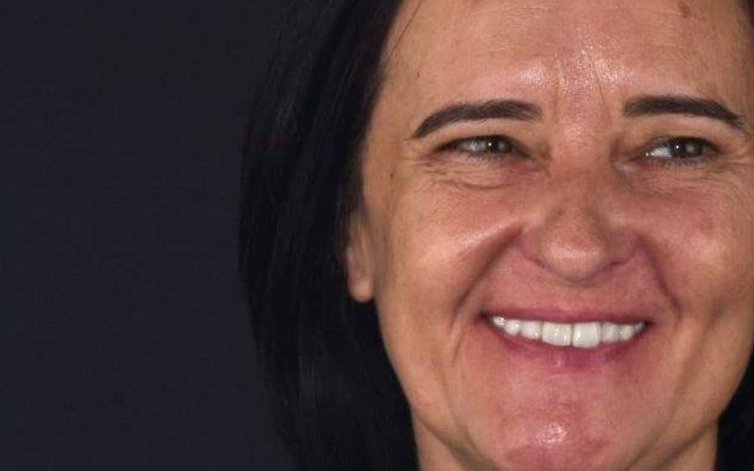 Reabilitação Oral Ana Mónica