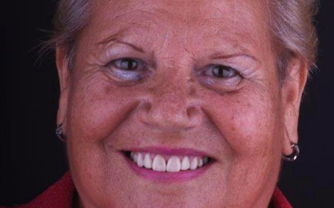 Coroas Dentárias dissilicato