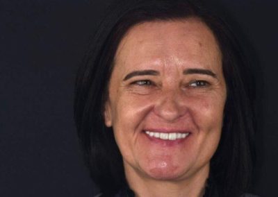 Reabilitação total- Ana Mónica