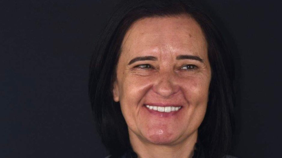 Full-mouth rehabilitation – Ana Mónica