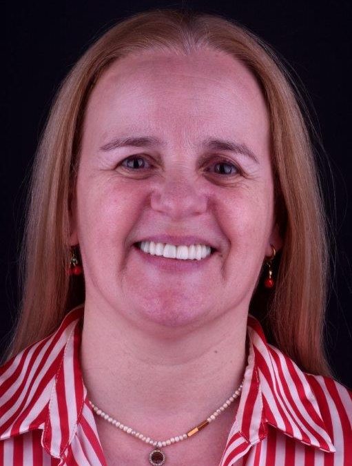 Dental Implants – Maria João