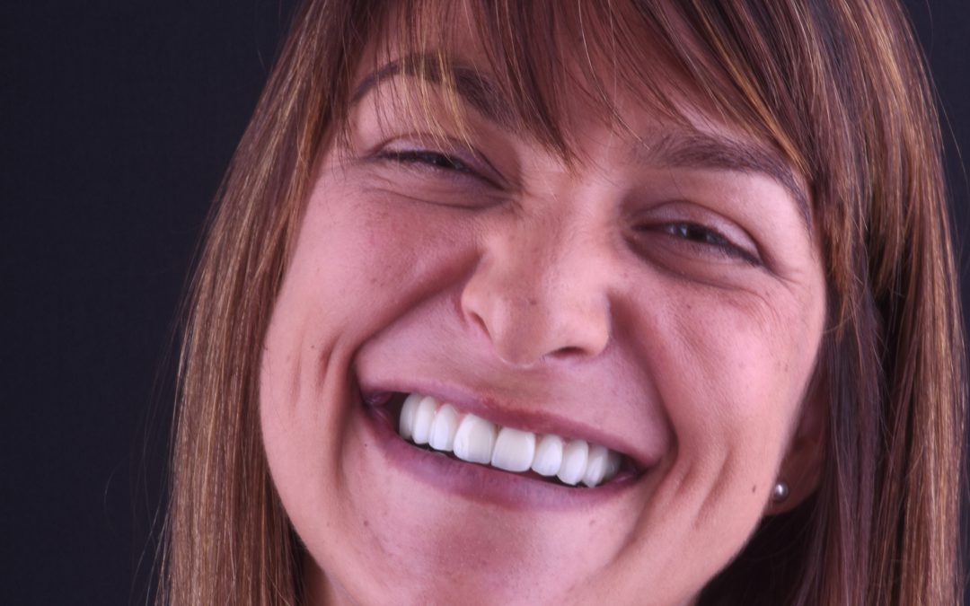 Total Rehabilitation: Sara Dinis
