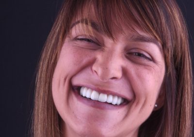 Total Rehabilitation: Sara Dinis